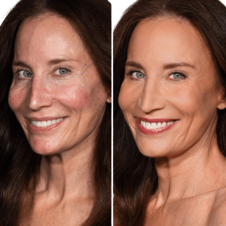 DermaGlow™ — Le fond de teint qui s’adapte à votre peau - Drainage