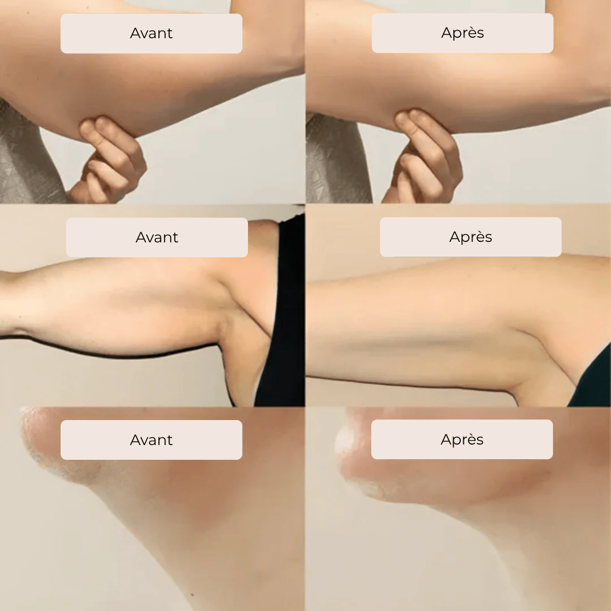 Drainage Lymphatique Liquide - Visage Affiné, Jambes Légères, Ventre Plat - DermaGlow