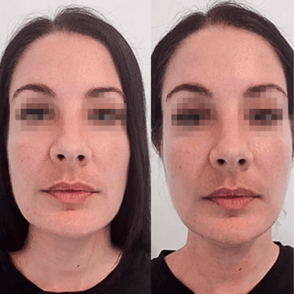 Drainage Lymphatique Liquide - Visage Affiné, Jambes Légères, Ventre Plat - Drainage